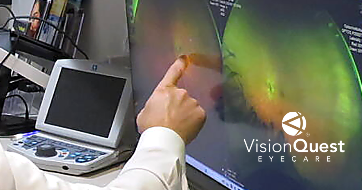 Eye disease management