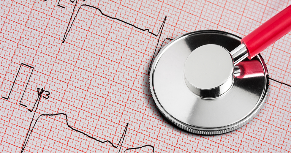 Your Cardiovascular Health Impacts Your Eye Health | VisionQuest Eyecare