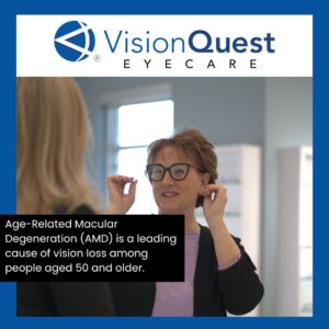macular degeneration management