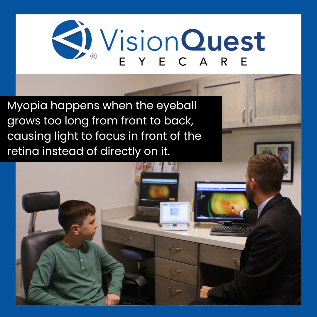 does myopia get worse